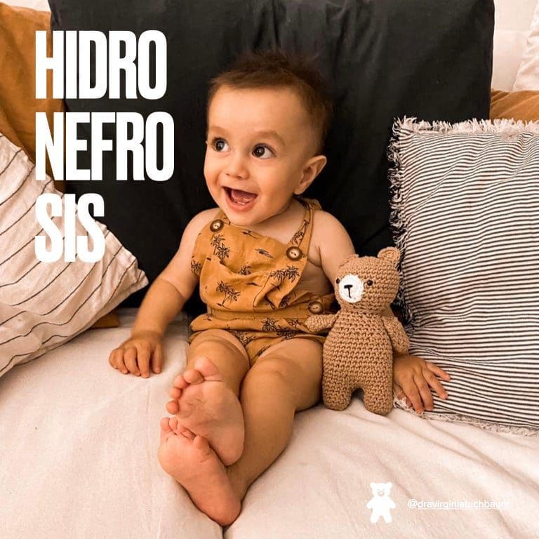 Esquema del riñón, el uréter y la vejiga: hidronefrosis, estenosis pieloureteral y reflujo vesicoureteral.