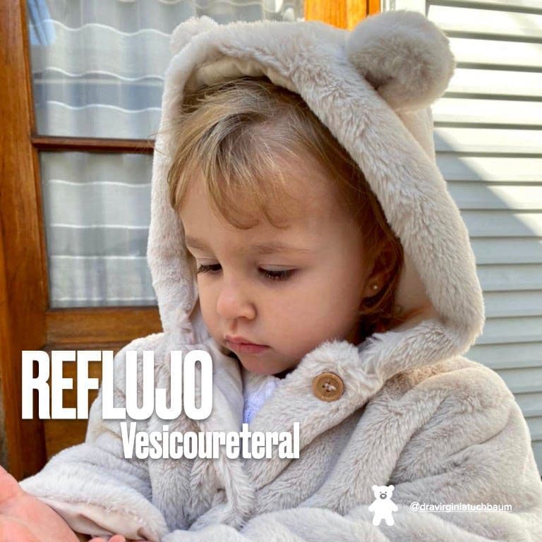 Esquema del reflujo vesicoureteral: la orina de la vejiga vuelve hacia el riñón por el uréter.